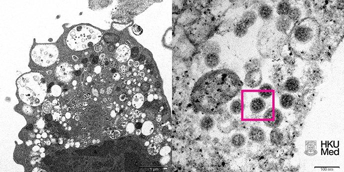 香港大學公布在顯微鏡下Omicron變種病毒。（取自《澎湃新聞》）