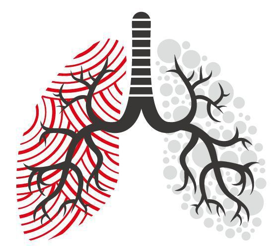 肺纖維化 圖/123RF