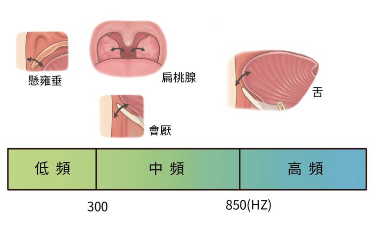 不同部位會發出不同頻率的鼾聲，懸雍垂、軟顎屬低頻：扁桃腺與會厭為中頻：舌頭為高頻...