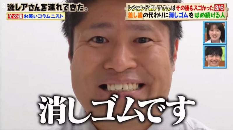 经过了4年，艺人Yoshimatsu仍在使用着「橡皮擦门牙」。图／《激レアさんを连れてきた》截图(photo:UDN)