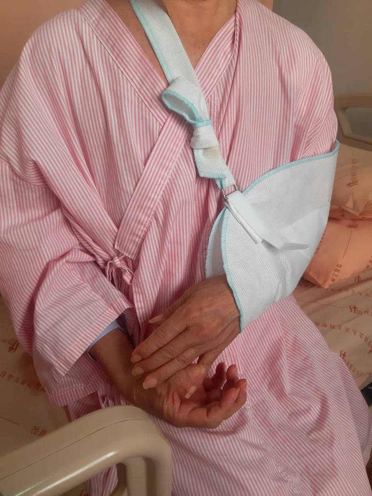 嘉義市蔡姓婦人騎機車緊急煞車，造成左手肱骨擠壓性的壓迫性骨折，手術後已出院。圖／...