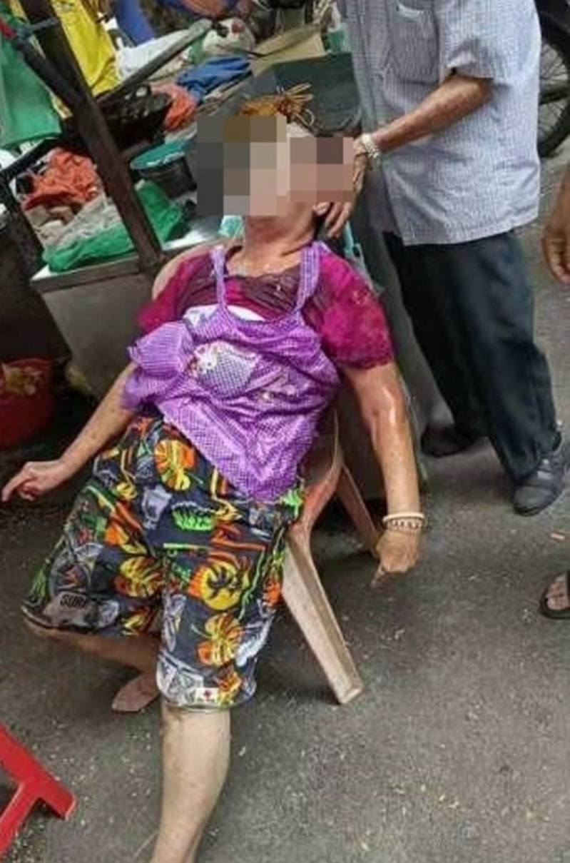 婆婆受伤后无法说话，全身力地躺在椅子上待救。 图／翻摄自网路图片(photo:UDN)