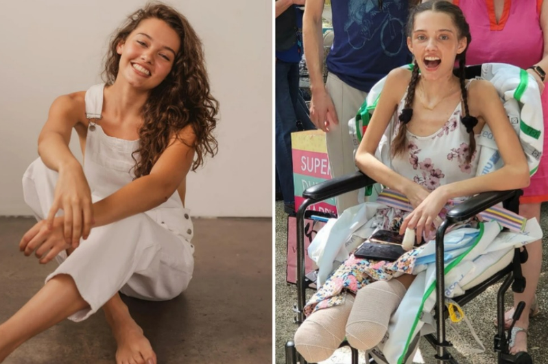21岁女模因新冠併发症失去双腿。图／取自(photo:UDN)
