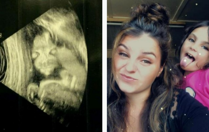 孕妈照超音波看到肚中女儿影像像恶魔。目前女儿已7岁(右图)。图／取自(photo:UDN)