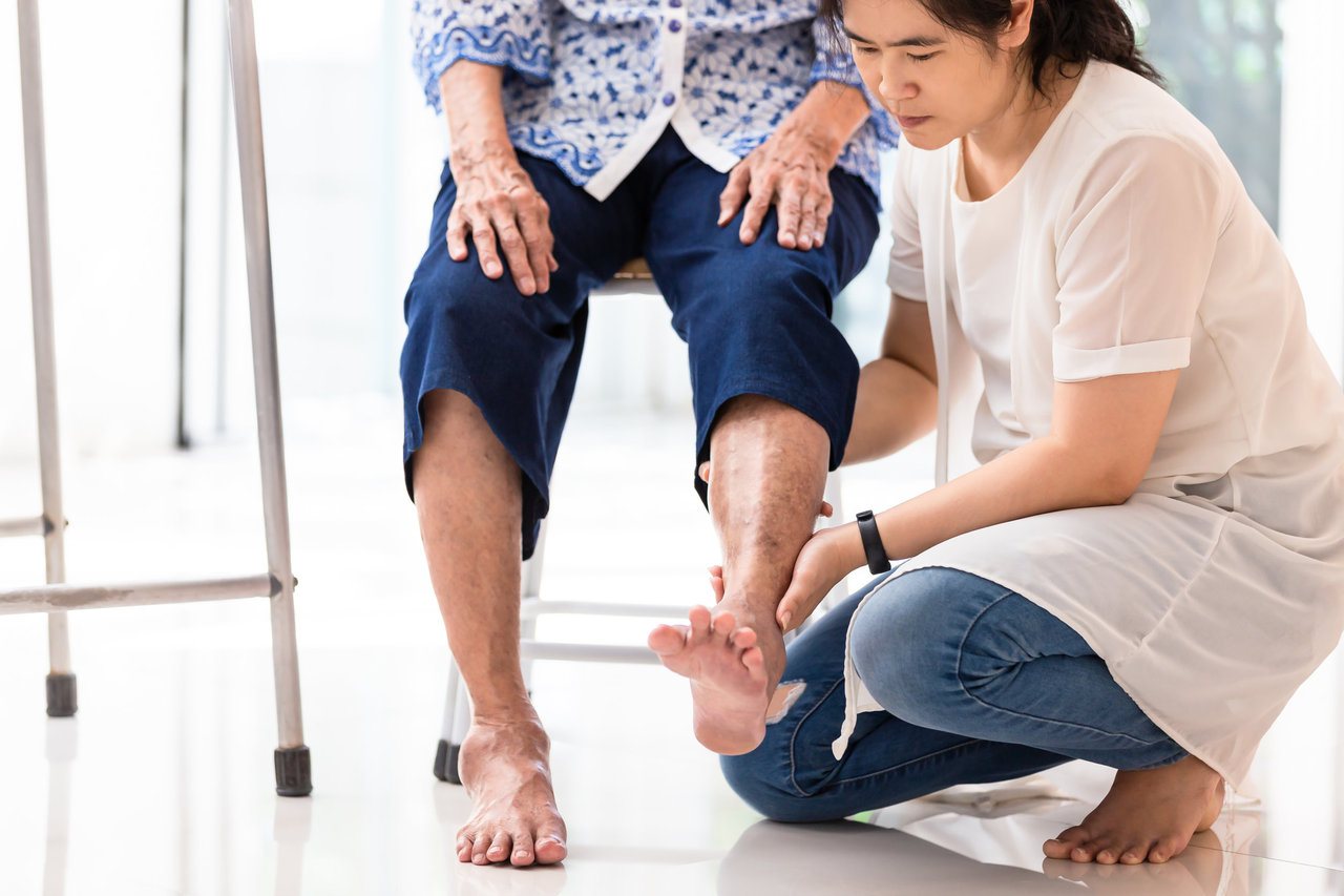退化性膝關節炎是一常見於中老年人，女性多於男性好發，一般常見症狀有膝關節疼痛、僵硬、卡卡聲響等，尤其是跑跳、上下樓梯或蹲等動作會更加劇症狀的程度。圖／123RF