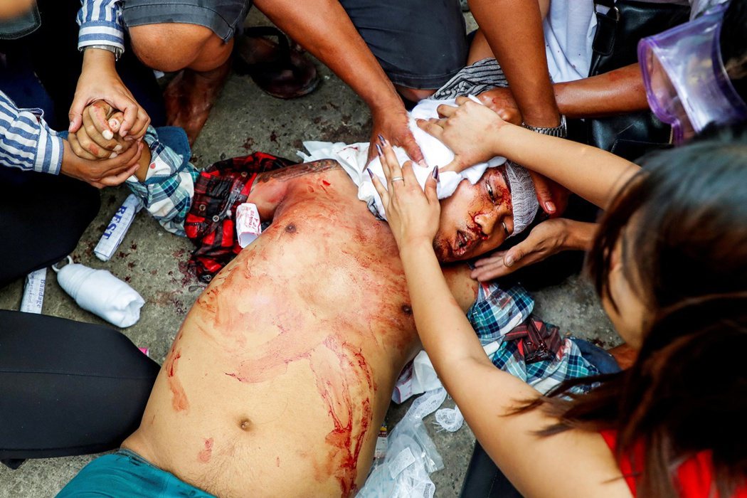 2021年3月17日，在緬甸仰光的抗議者遭到鎮壓，一名成員遭到警方槍擊，頭部中彈...