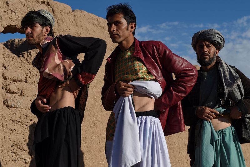 愈來愈多阿富汗人靠著非法交易器官，來度過前所未有的人道主義危機。 法新社