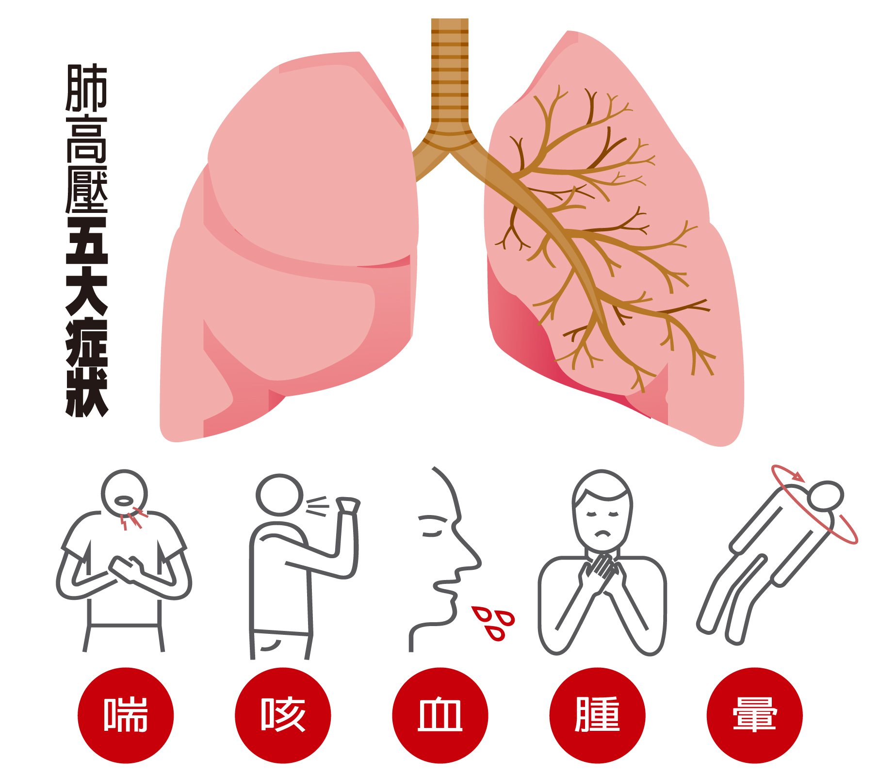 肺高壓五大症狀  製表/元氣周報    圖/123RF