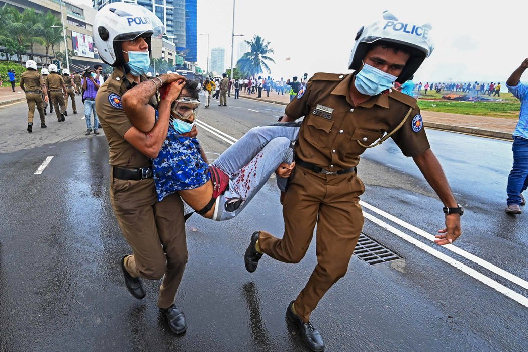 5月9日，斯里蘭卡總統辦公室外的政府支持者和示威者衝突期間，警察抬出一名浴血的男...