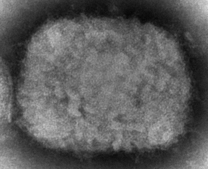 加拿大今天晚間通報國內出現2起猴痘（monkeypox）確診病例，使得歐洲和北美洲不斷增加的猴痘病例數越來越多。 美聯社