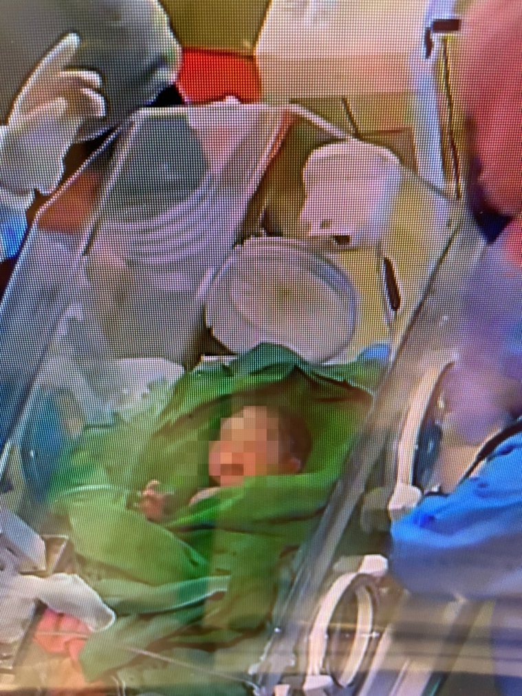 男嬰出生後先安置在保溫箱，小兒科許宸睿醫師表示男嬰出生時狀況良好，現在待在專門的...