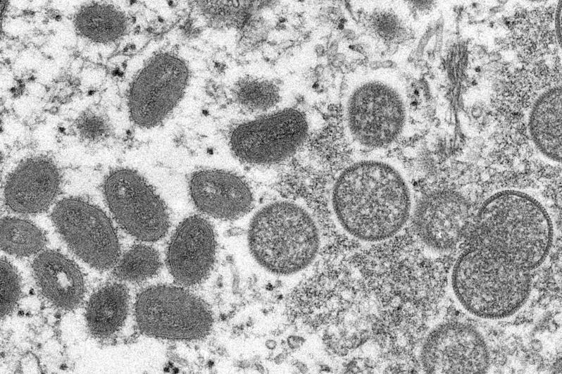 世衛專家23日稱猴痘疫情爆發，恐跟歐洲兩場大規模活動有關。美聯社