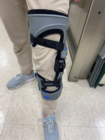 圖五/如果已經有下肢關節生物力學的形變造成壓迫或損傷時，則可使用退化性關節炎護膝...