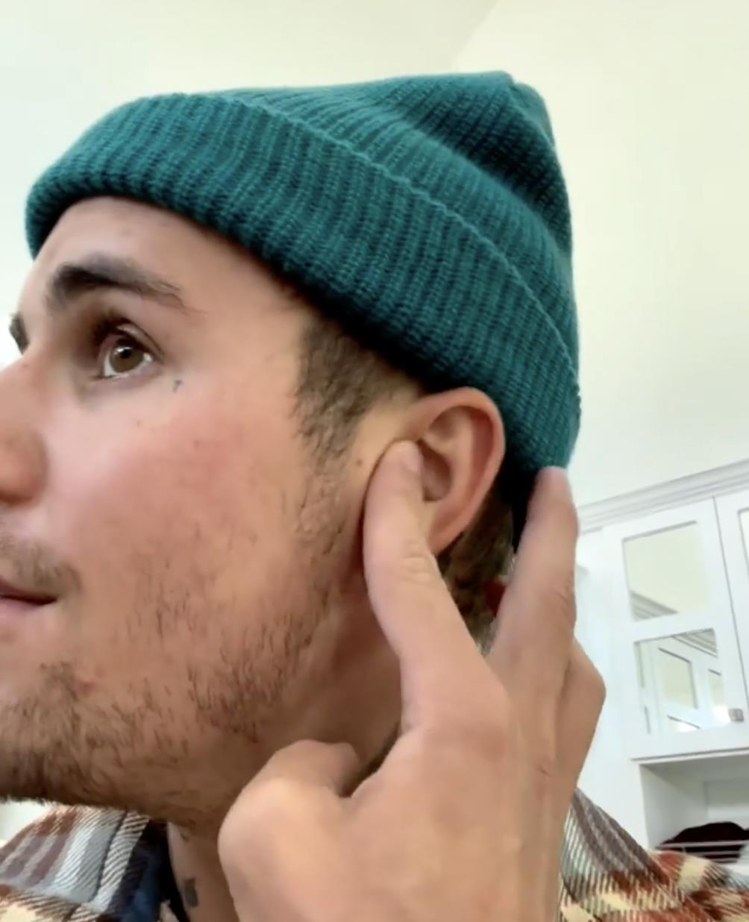 小賈斯汀拍短片解釋病毒攻擊他的耳朵和顏面神經。圖／摘自IG
