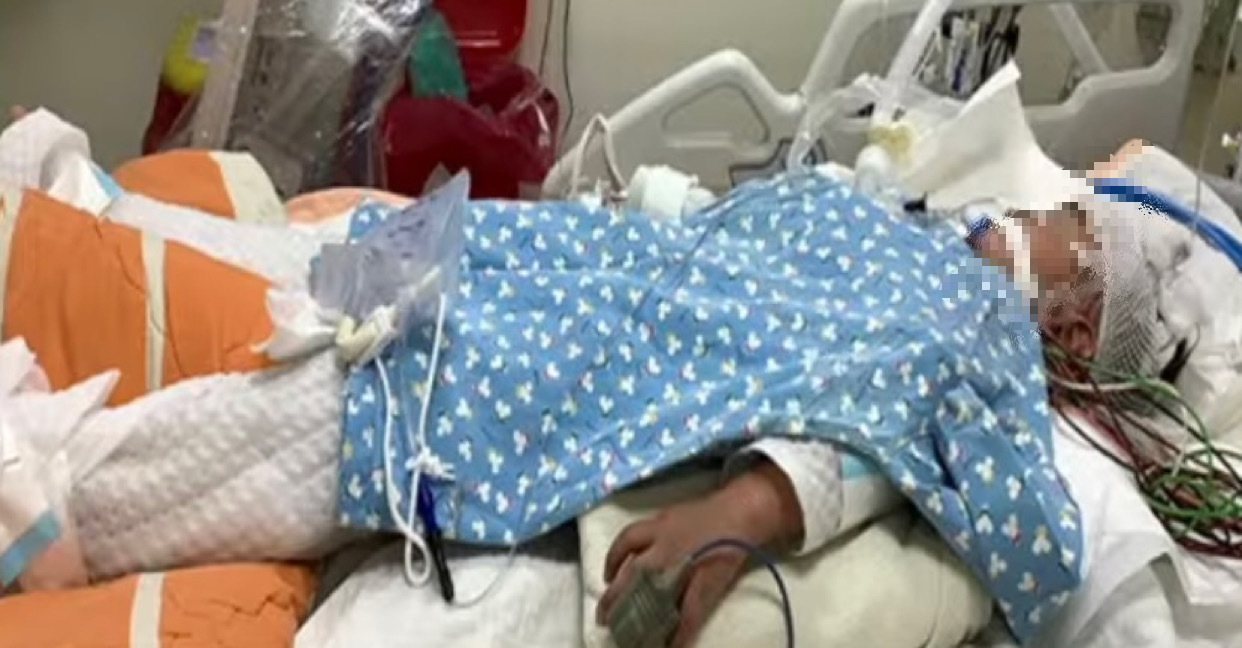 雲林六歲男童感染新冠肺炎後發生急性猛爆性肝炎，在加護病房裡身上插滿管子，讓爸媽非常心疼。圖／取自網路