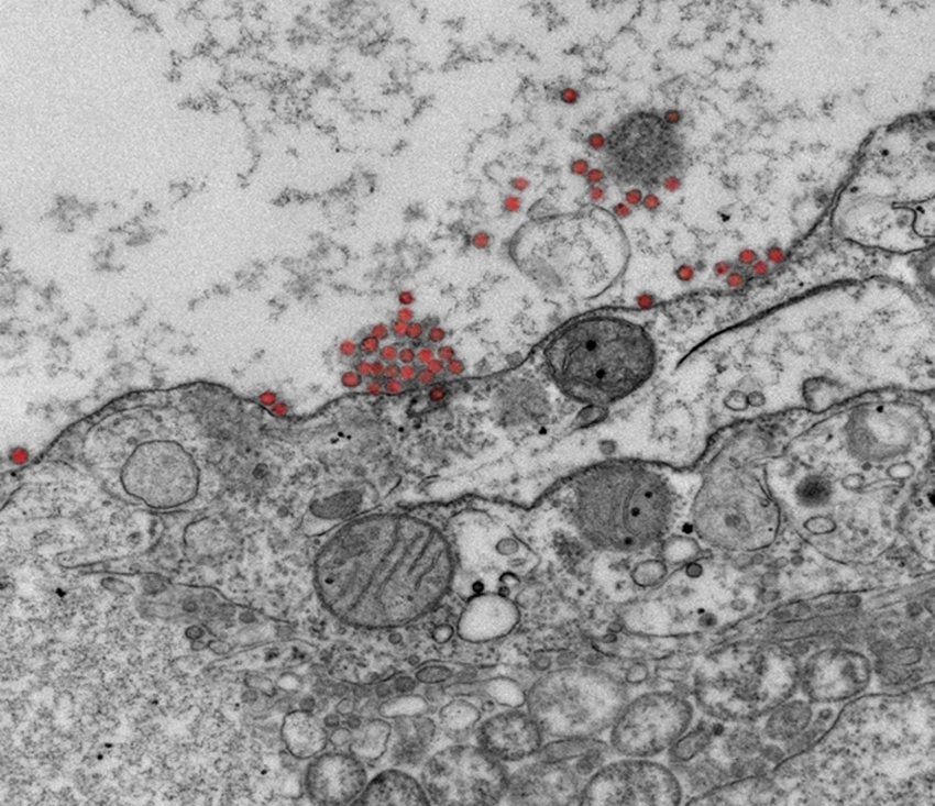 圖為電子顯微鏡下細胞受到新冠病毒(紅色)攻擊。 長庚大學/提供