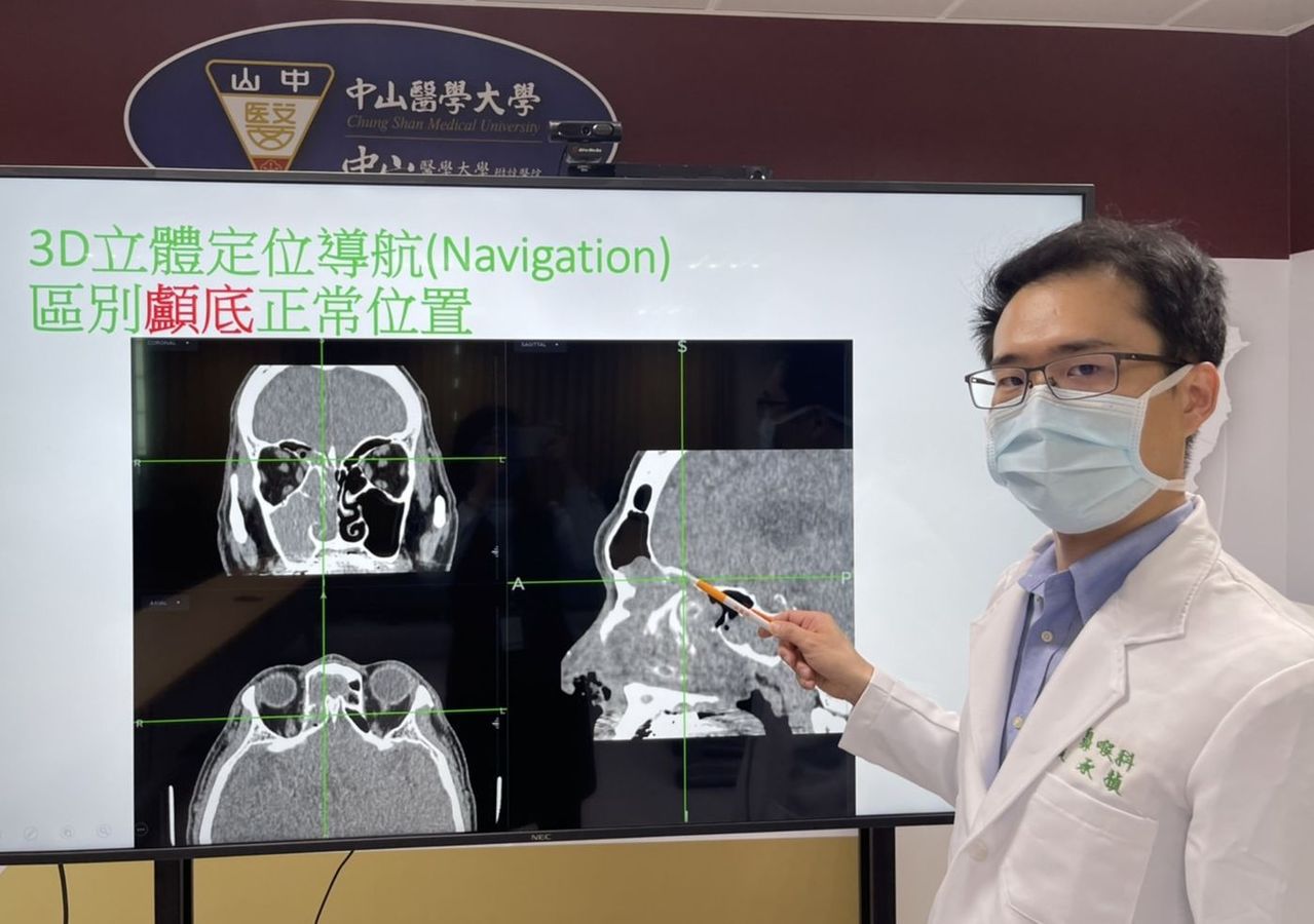 醫師黃承楨說明，張姓病患經3D鼻竇導航手術治療後，鼻塞等症狀都消失，恢復正常生活。圖／中山附醫提供