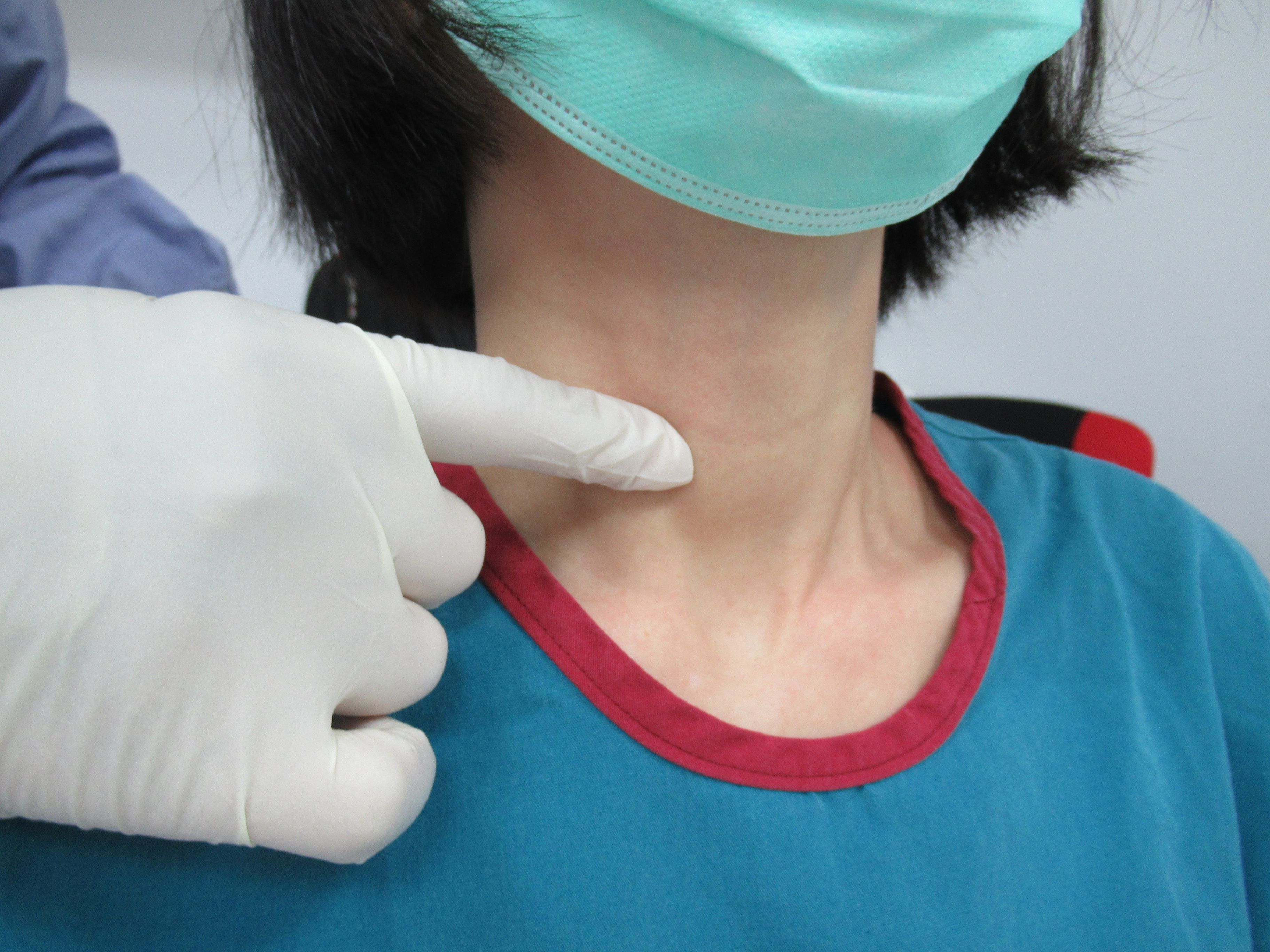 甲狀腺位在脖子喉結下方兩側，長了結節可摸得到。圖／秀傳亞洲遠距微創手術訓練中心提供