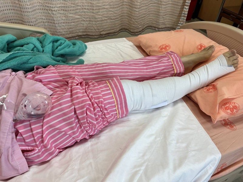 台中市長盧秀燕今完成腿部清創手術，正在醫院進行引流治療，下周持續向市府、議會請假。圖／台中市政府提供