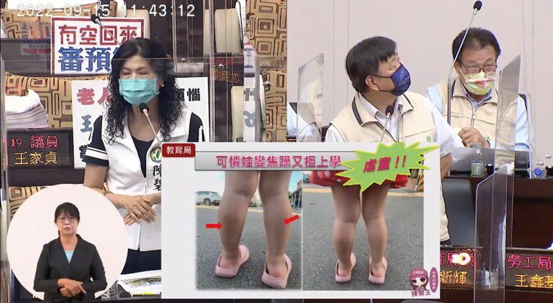 台南市議員陳碧玉今在議會出示一張照片幼幼專班小朋友小腿瘀傷，疑似有虐童。記者吳淑玲／攝影