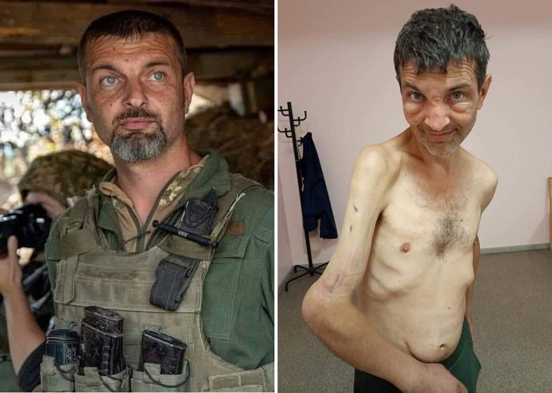 烏克蘭陸戰隊士兵迪安諾夫遭到俄軍俘虜後，21日在換俘行動中獲釋。但從曝光的照片可見，他與被俘前判若兩人，不但嚴重消瘦，右臂也變形，不難想像俄軍如何對待戰俘。圖／取自Twitter@DefenceU