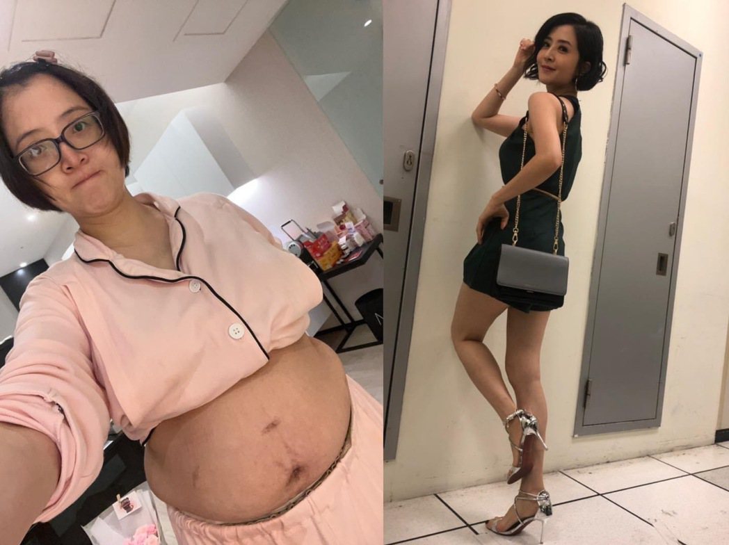 李亮瑾po出產後與懷孕前身材對照。圖／摘自臉書
