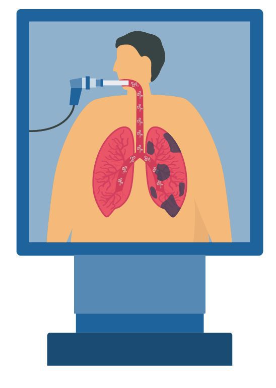 若民眾出現喘、咳等呼吸道症狀，都鼓勵進行肺功能檢測。圖/123RF