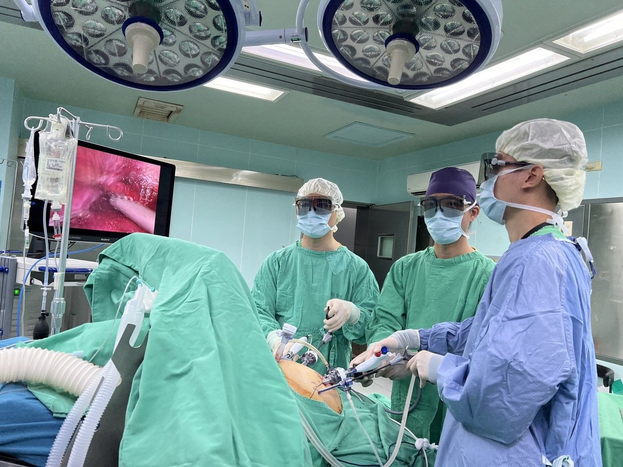 衛福部南投醫院外科醫師彭正明、黃信傑醫師進行3D腹腔鏡肝及膽囊切除手術照。圖／南投醫院提供