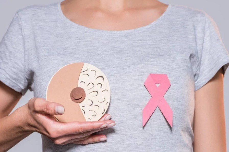 「抗體藥物複合體」（ADCs）副作用低兼具邊際治療效應，提供晚期乳癌病友治療新選擇。圖╱123RF