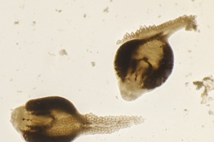 伍德研究團隊從一條保存完好的銅平鮋鰓中，分離出單基因蠕蟲。研究小組發現，在這些寄生物種中，溫度每升高攝氏1度，寄生蟲就減少38%，這項發現更與海面溫度顯著相關。紐約時報