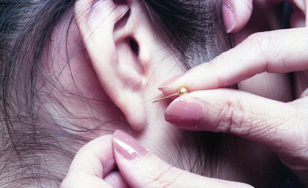 避免打耳洞、刺青、霧眉和不必要的手術，以免出現不必要的傷口引發蟹足腫。圖為民眾穿耳洞情形。