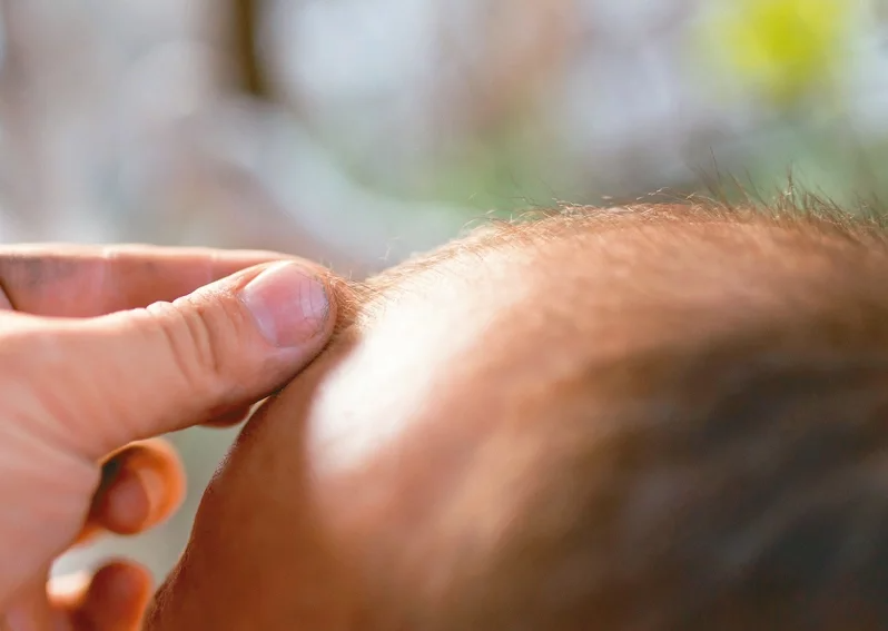 壓力大會掉髮，若每天掉髮超過100根，小心出現頂上無毛狀況。 圖／123RF