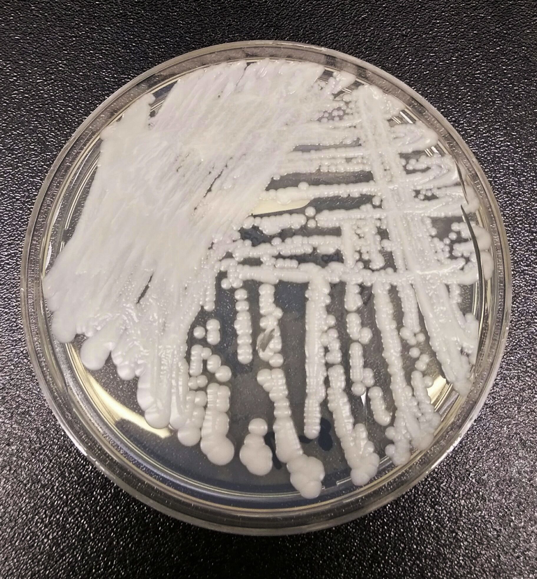 CDC提供的這張照片顯示培養皿中培養的「耳念珠菌」。 全美逾半的州已有病例。 (美聯社)