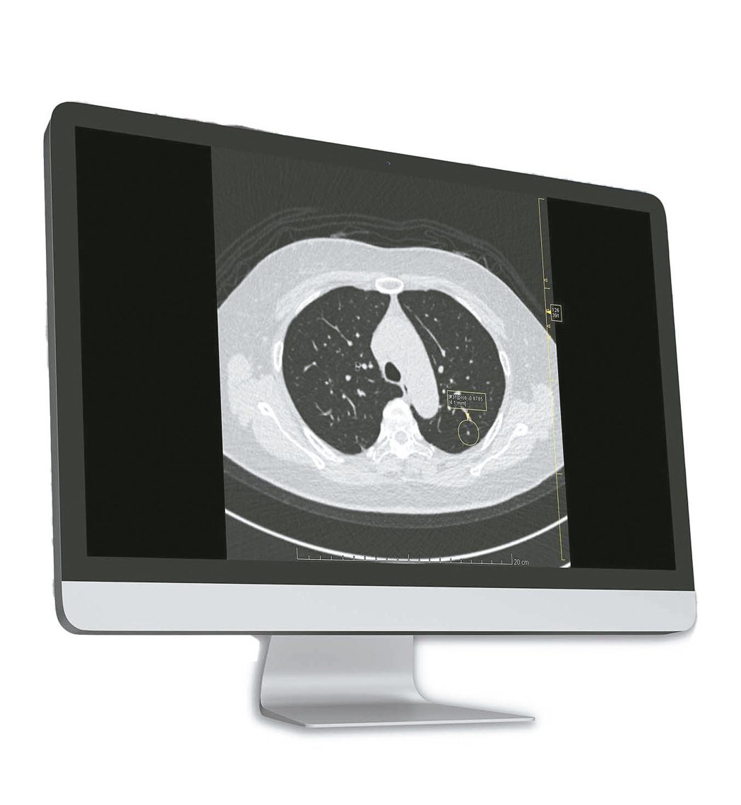 倍利科技推出肺部影像輔助判讀系統。倍利科技／提供