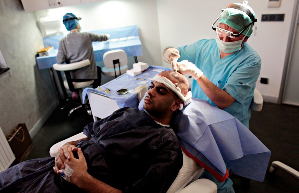 一名來自英國的男子在土耳其伊斯坦堡接受植髮手術。 圖／路透社  