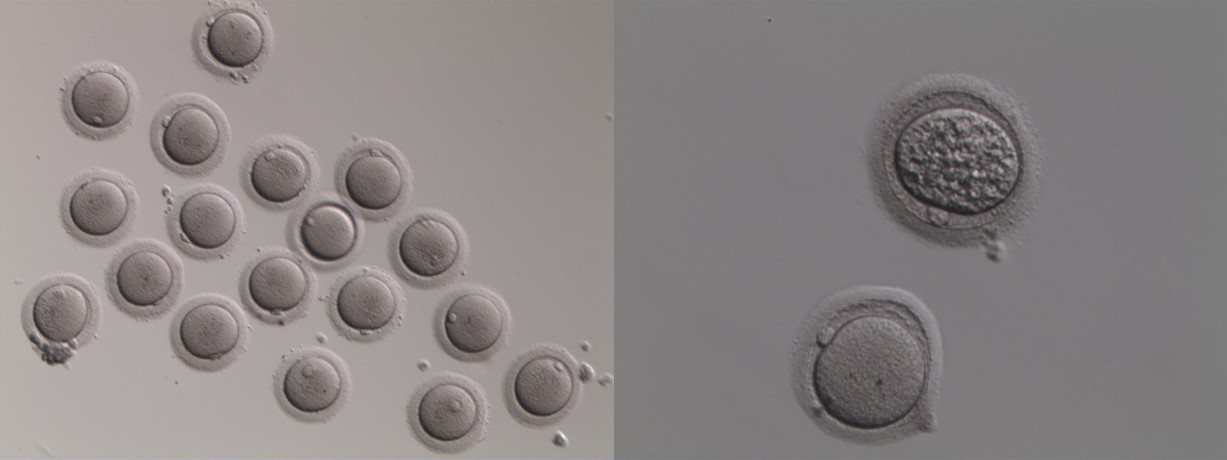 卵子對比照，年輕卵（左）高齡卵（右）。圖／台灣凍卵協會提供