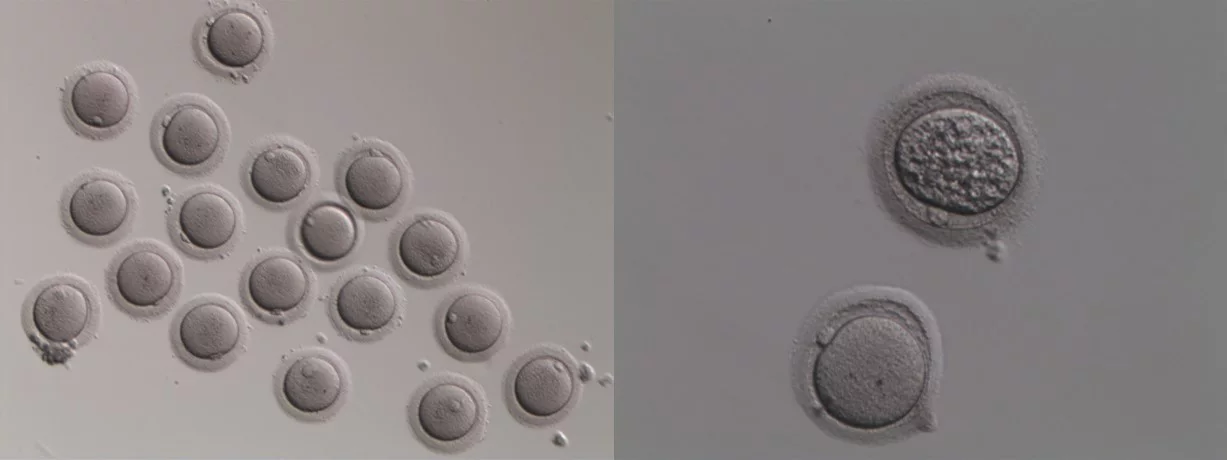 卵子對比照，年輕卵（左）高齡卵（右）。圖／台灣凍卵協會提供