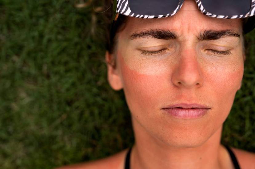 夏天紫外線強烈，不僅容易曬黑曬傷，若沒做好防禦，長年下來恐長出斑點、肌膚老化、甚...