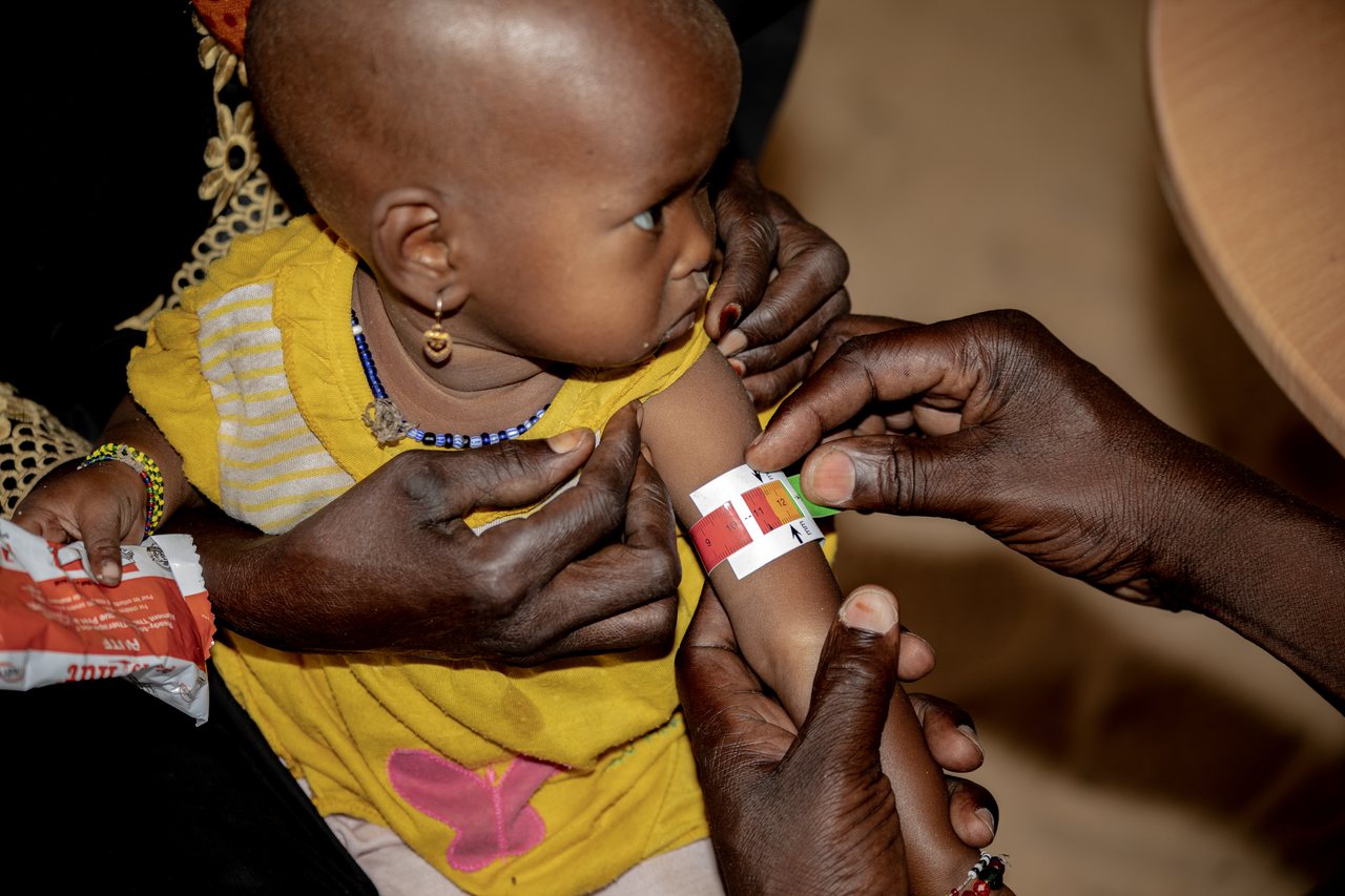 無國界醫生利用上臂中圍測量尺（MUAC）測量孩子木沙是否營養不良。照片／無國界醫生提供