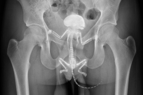 松鼠卡在男子直腸裡，X光下清晰可見。圖取自teakdoor.com