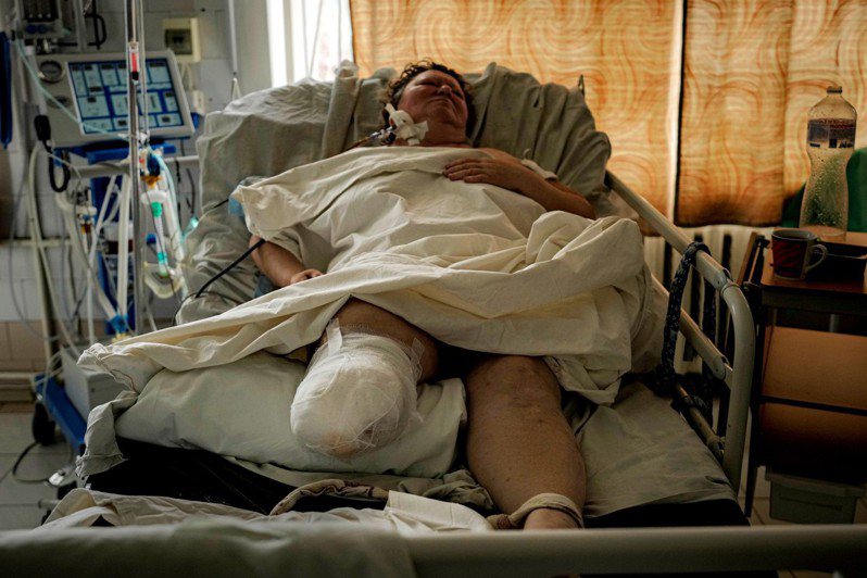 Травма 20 тысяч ампутированных конечностей: дефицит протезов конечностей в Украине и проблемы физической и психической реабилитации |  Последние 24 часа |  udn Global