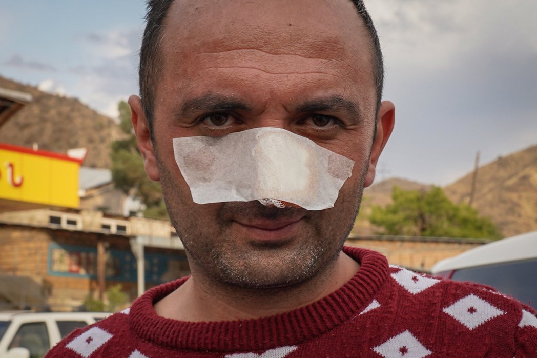 58歲的Ashot是共和國內的自衛隊員，他經過檢查站時為了避過亞塞拜然士兵捉捕捉...