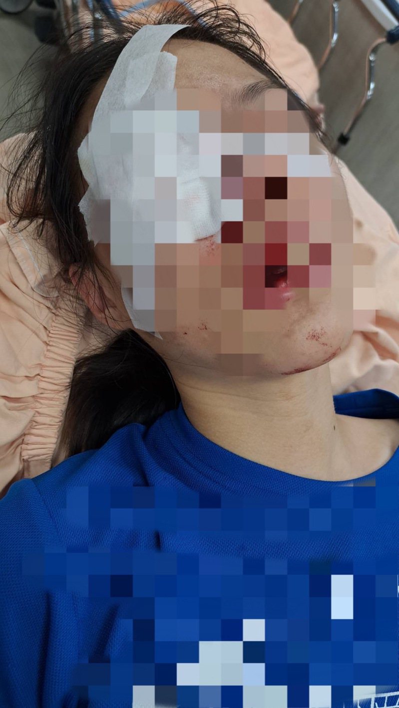 台南市一名國三女生5月間在學校遭同學持鋁棒砸傷頭部，急救才挽回性命，家長控因對方是特殊生，事件被消極處理。圖／讀者提供