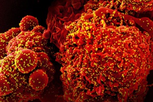 誕生屆滿2年，Omicron仍穩居新冠病毒中的強勢地位，證明它不僅具有驚人傳染力，更被視為「演化奇觀」。圖為電子顯微鏡掃描下，細胞（紅色）遭Omicron病毒粒子（黃色）感染。紐約時報
