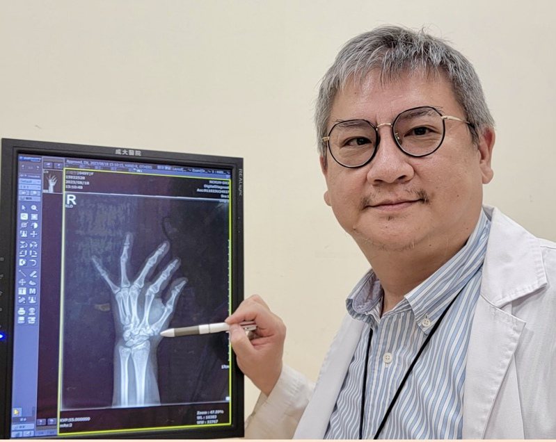 手部拇指基底關節炎X光檢查可能出現關節錯位、間隙狹窄等症狀。圖／醫師楊岱樺提供