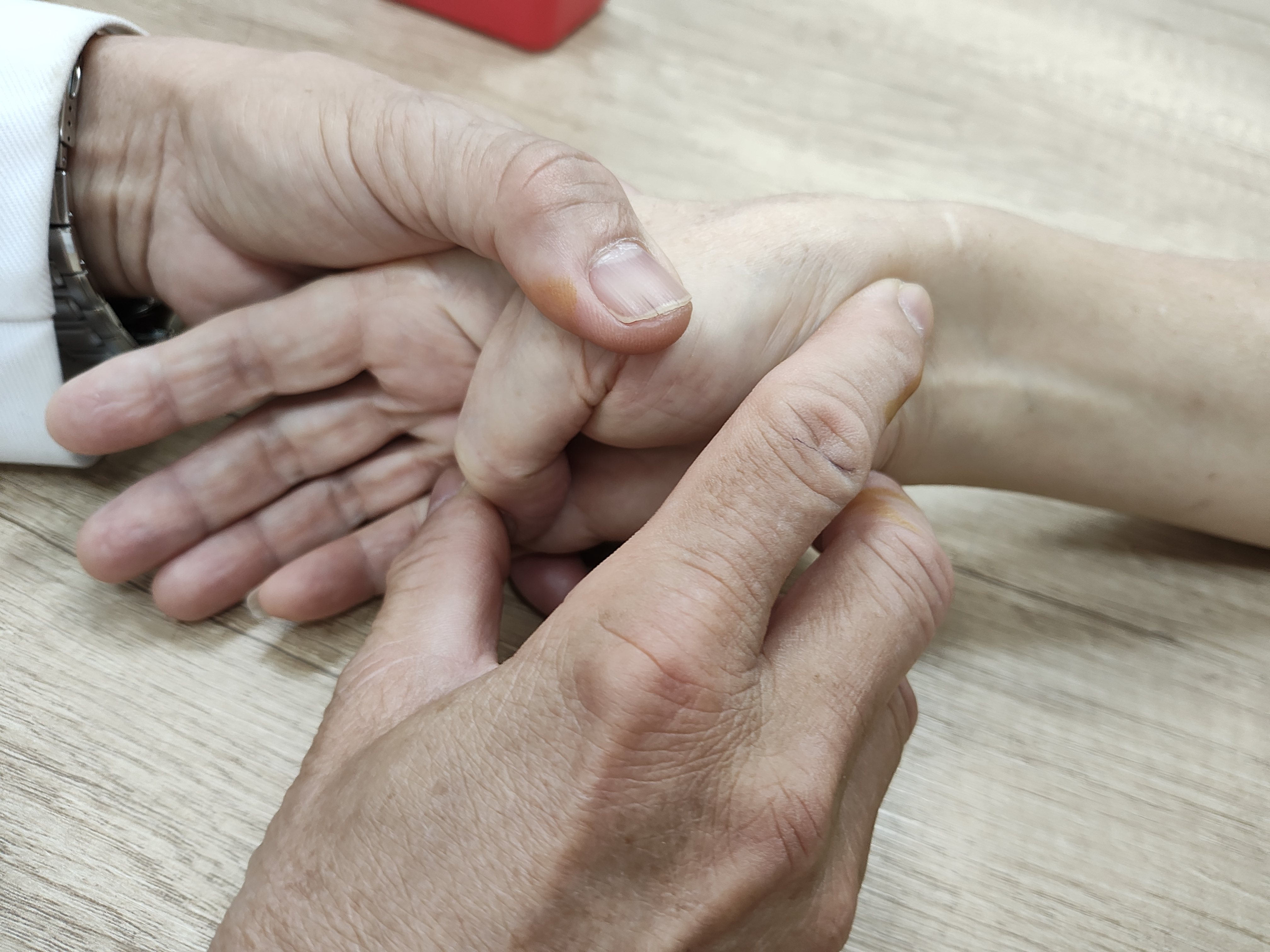 骨科醫師林高田指出想確認是否有「媽媽手」可以芬可斯坦測驗(Finkelstein-Test)自我檢測，方法是抓住大拇指包在四指內，握拳將手腕向下壓，若大拇指根部疼痛即有可能是「媽媽手」。圖／中正脊椎骨科醫院提供