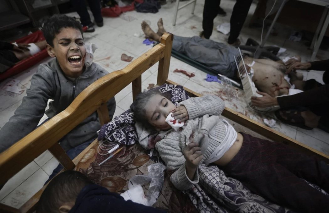 加薩空襲中受傷送入醫院的兒童。 圖／美聯社