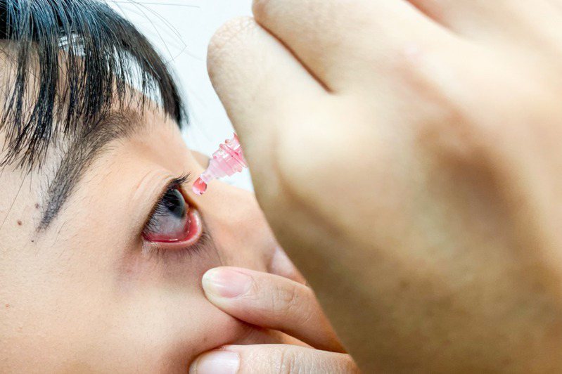角膜受損、眼睛發炎的人，不建議自行購買使用涼感眼藥水。示意圖非新聞當事人，本報資料照片