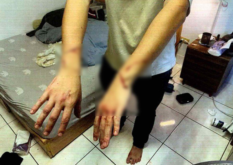 男大生的手被猫咪反击抓伤，布满血痕。图撷自新北动保处