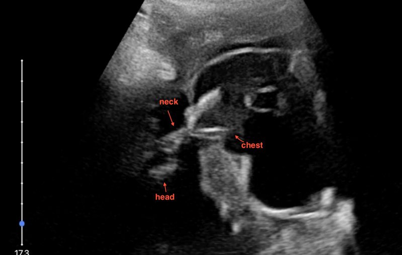 「貘莉」宝宝的超音波影像，预计小家伙6月就会报到。图／台北市立动物园提供